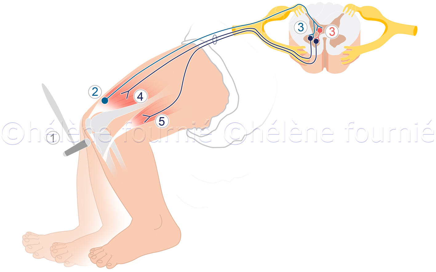 Osteotendinous Reflexes in Young Children