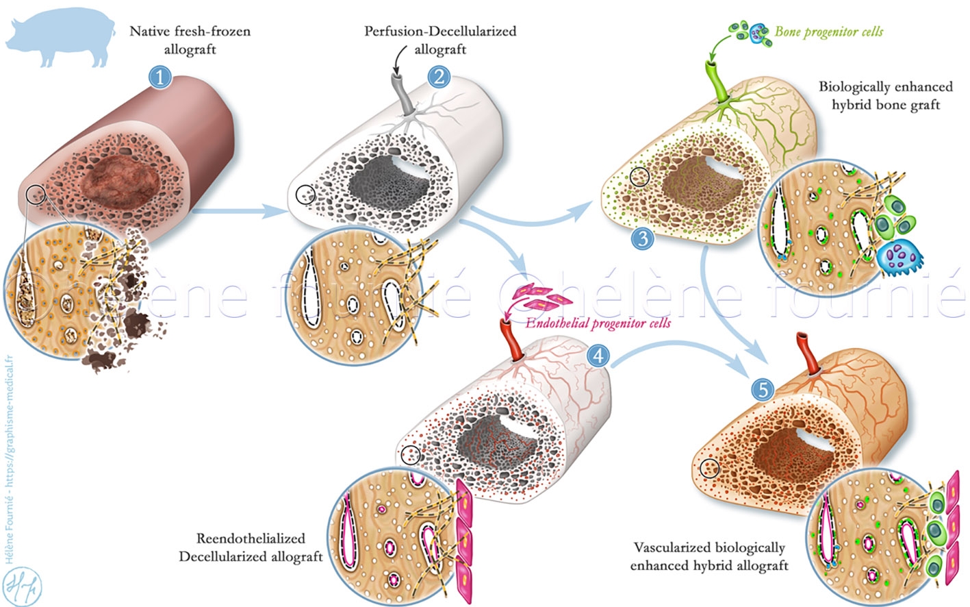 Illustration these osteointegration