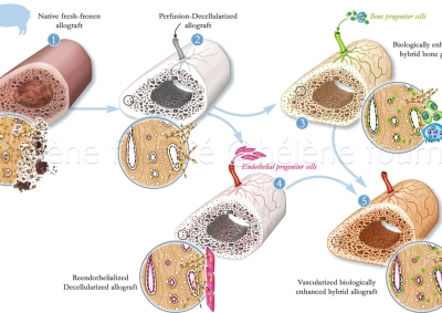 Illustration these osteointegration