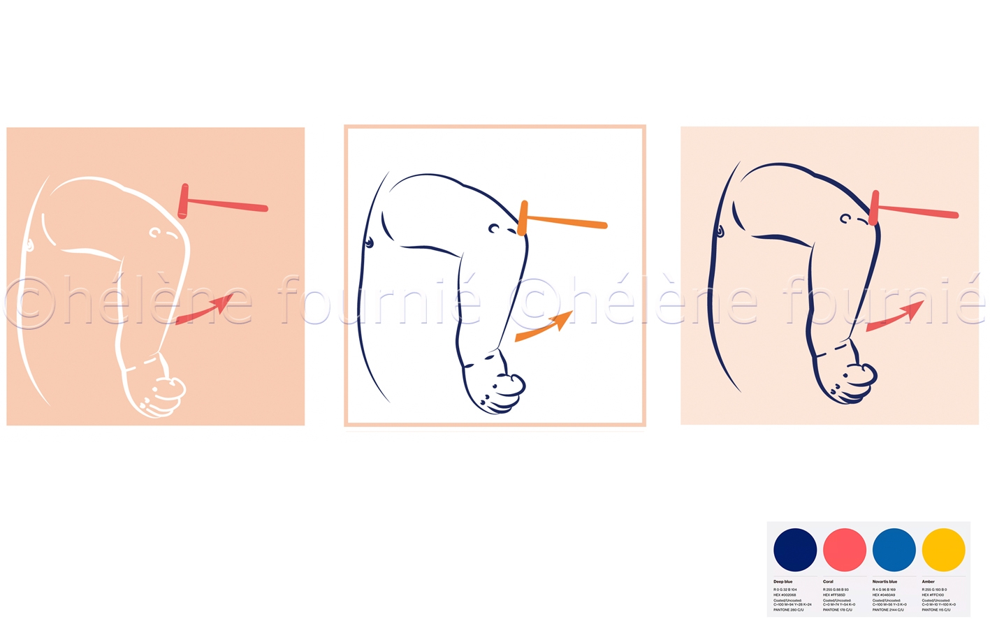 Osteotendinous Reflexes in Young Children