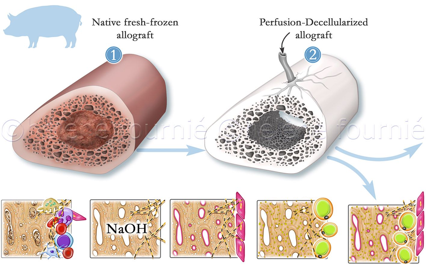 osteoreconstruction-helene-fournie2