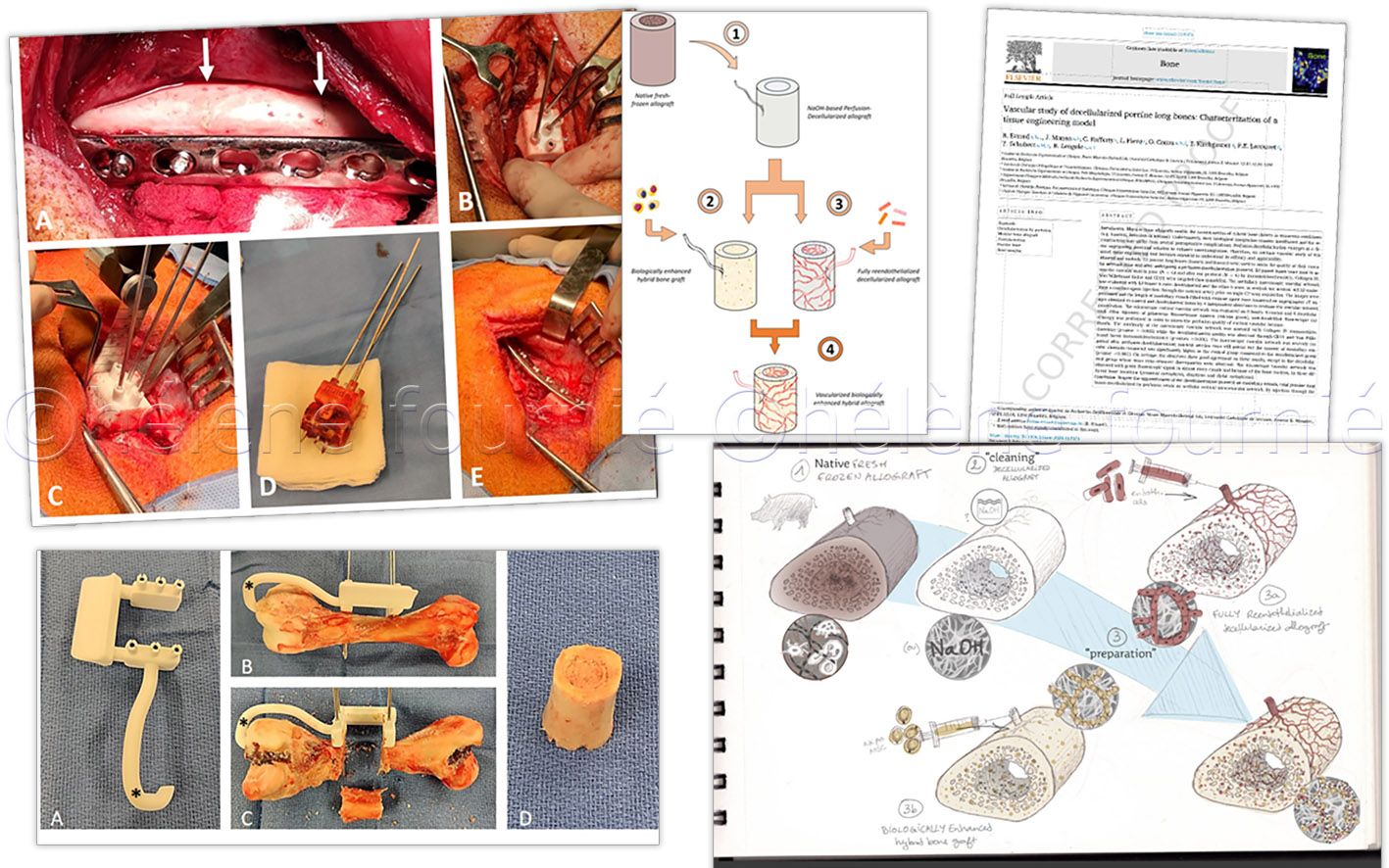 osteoreconstruction-helene-fournie1