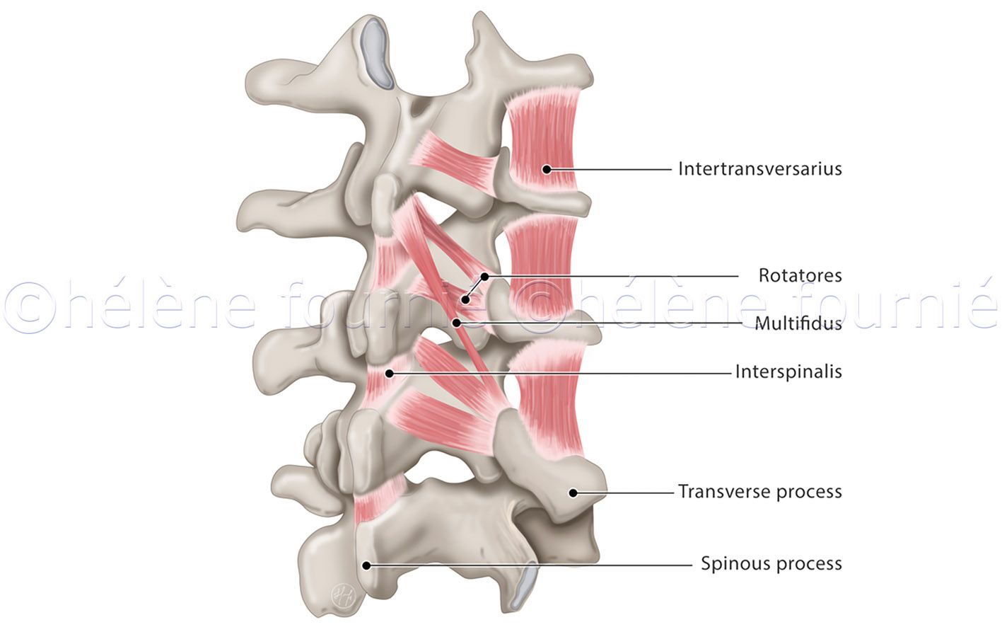 neckSurgery3